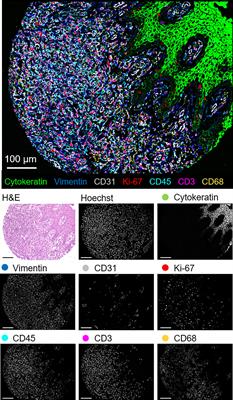 Highly Multiplexed Phenotyping of Immunoregulatory Proteins in the Tumor Microenvironment by CODEX Tissue Imaging